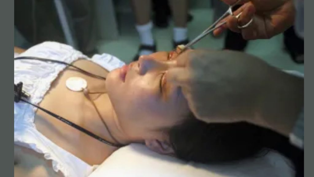 Disadvantages Of Donating Your Body To Science